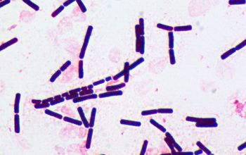 Bacillus cereus در زیر میکروسکوپ