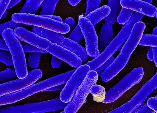 اشریشیا کلی E coli