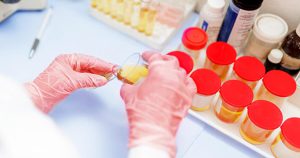 آزمایشات ادرار Urine Test