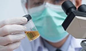 اصلاحات داخل آزمایش ادرار